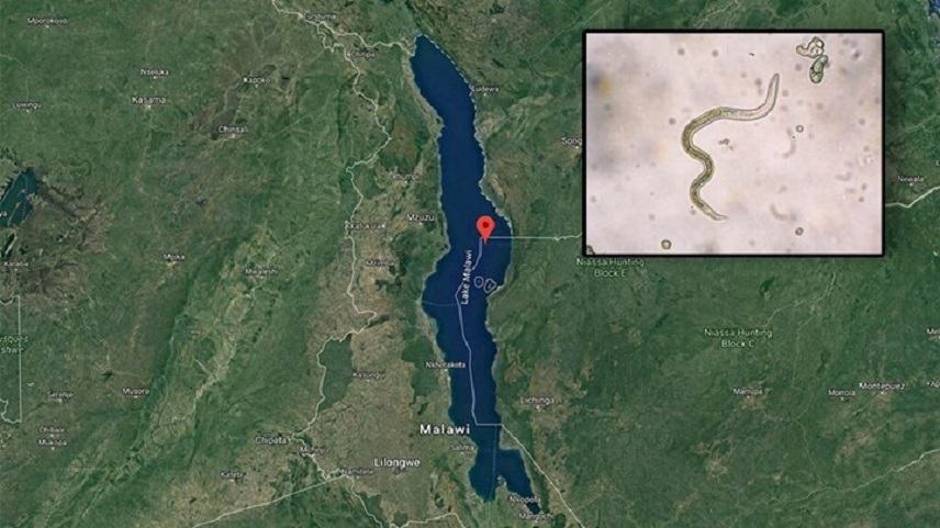 Η βουτιά σε λίμνη έγινε εφιάλτης για 32χρονο
