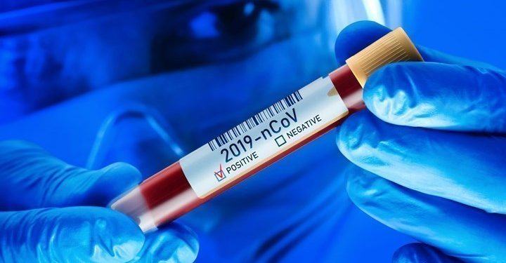 Ερευνητές υποστηρίζουν ότι εξουδετέρωσαν τον κορωνοϊό χωρίς εμβόλιο