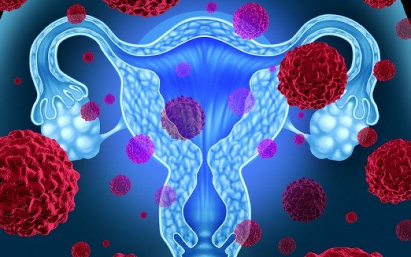 Ηράκλειο: Επιστημονική εκδήλωση εναν καρκίνο που απειλεί τις γυναίκες